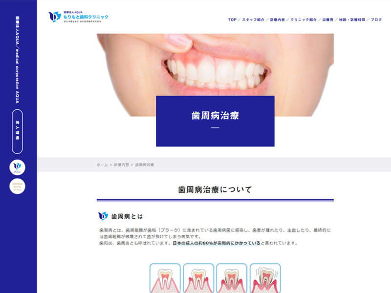 徹底した衛生管理と患者さんの歯の健康を考えた歯周病治療「もりもと歯科」